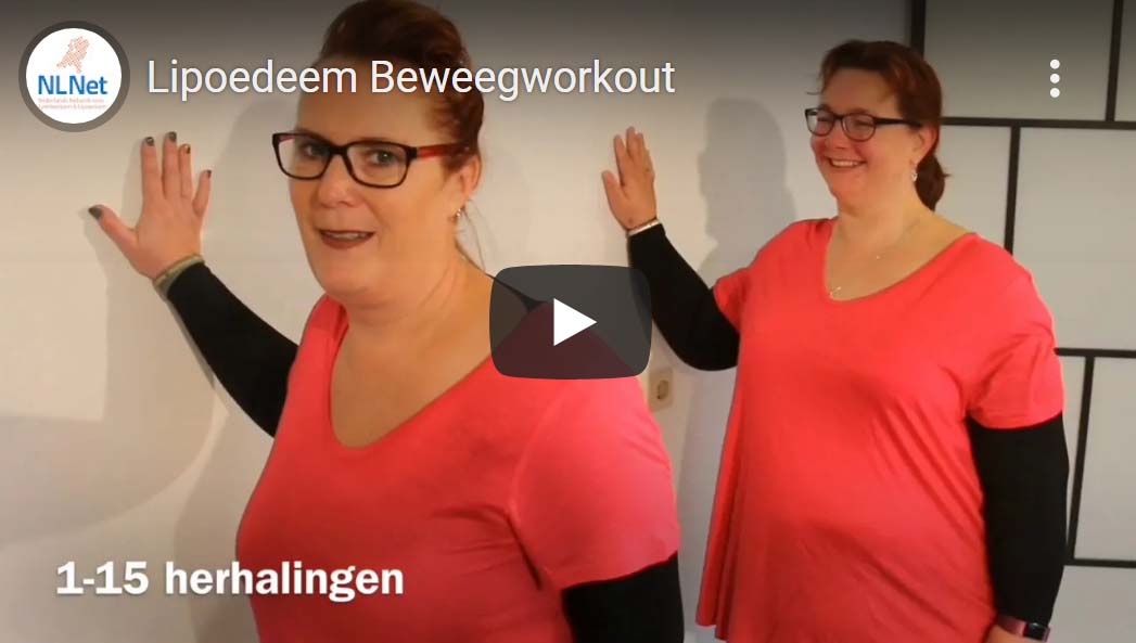 Bewegen met lipoedeem