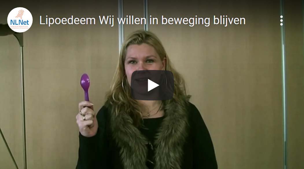 In beweging blijven met lipoedeem